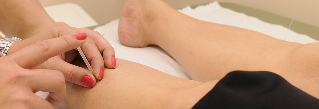 10 Conversation Starters Questions About Acupuncture